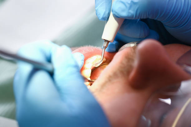 Professional Emergency Dentist in TN